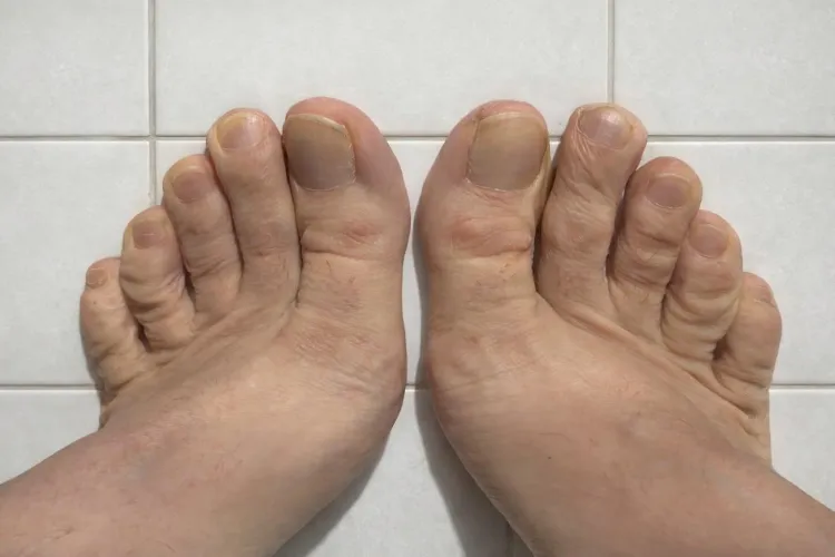 Toes by Admirable-Warning-23