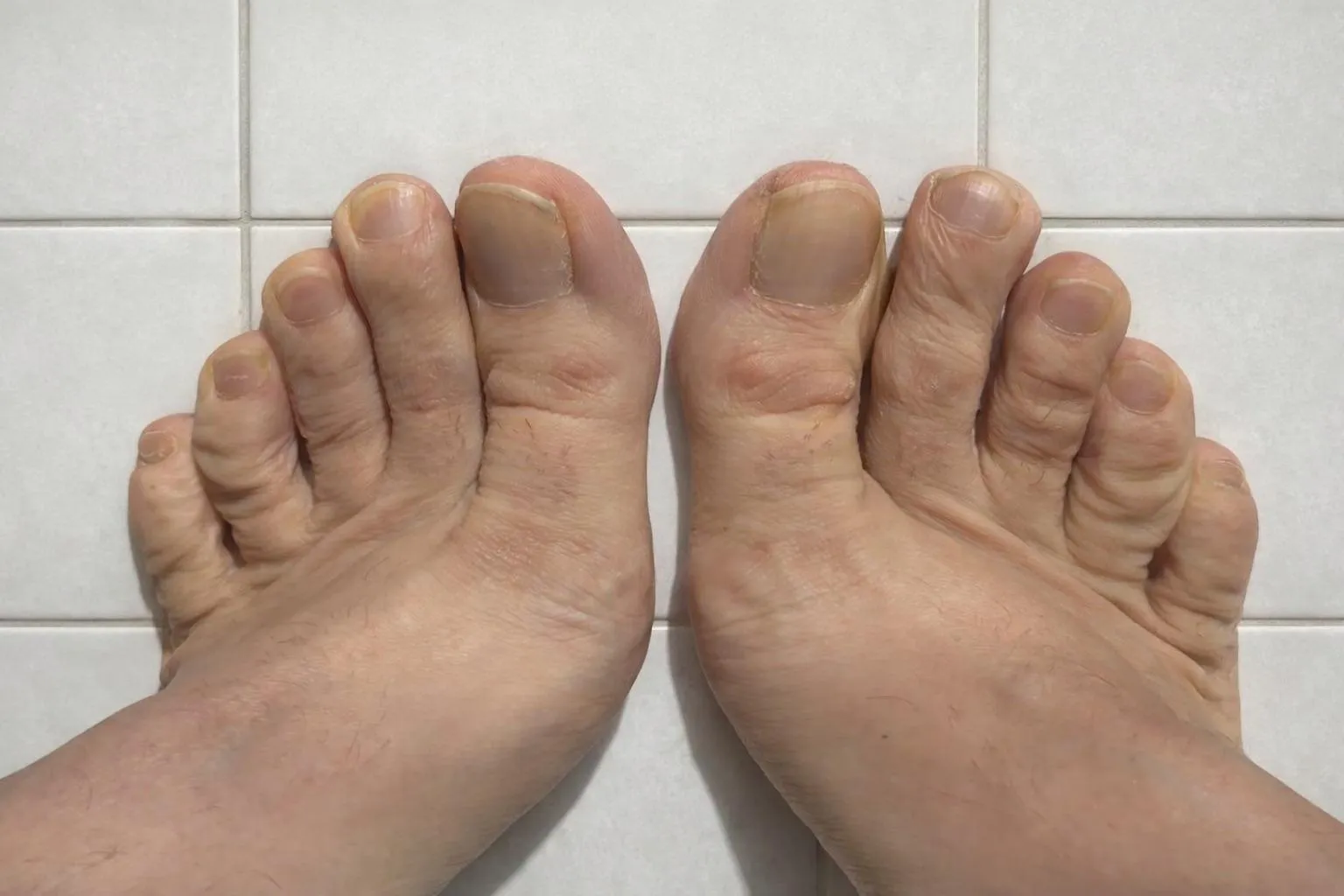 Toes posted by Admirable-Warning-23