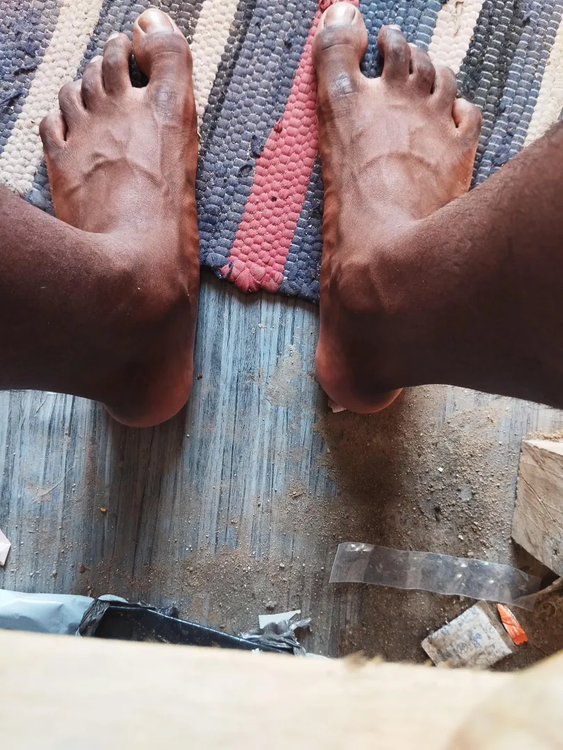 Too much veins? (19M) posted by OmRaj_Edits