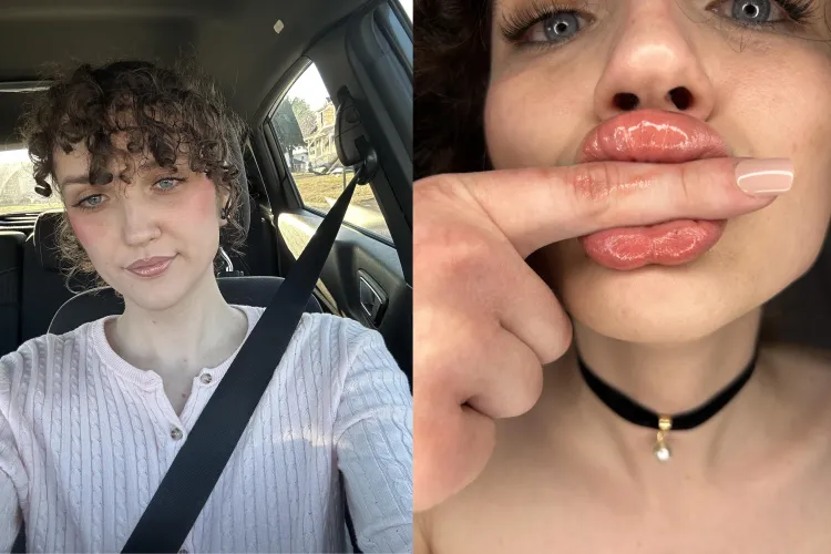 Trans girl beginning my journey! lip filler and cheek filler for my first upgrades by dangerdoll_1