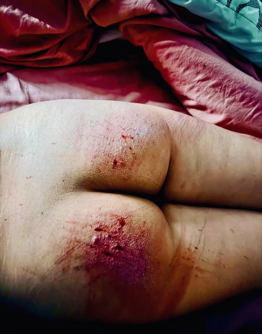 (TW: blood) Lesson learnt, accountability always leaves a mark posted by Lilbratkaylah