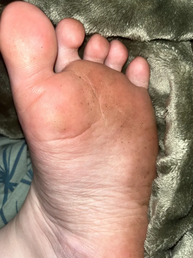 Ughh i need someone to clean them posted by Livid_Philosopher_37