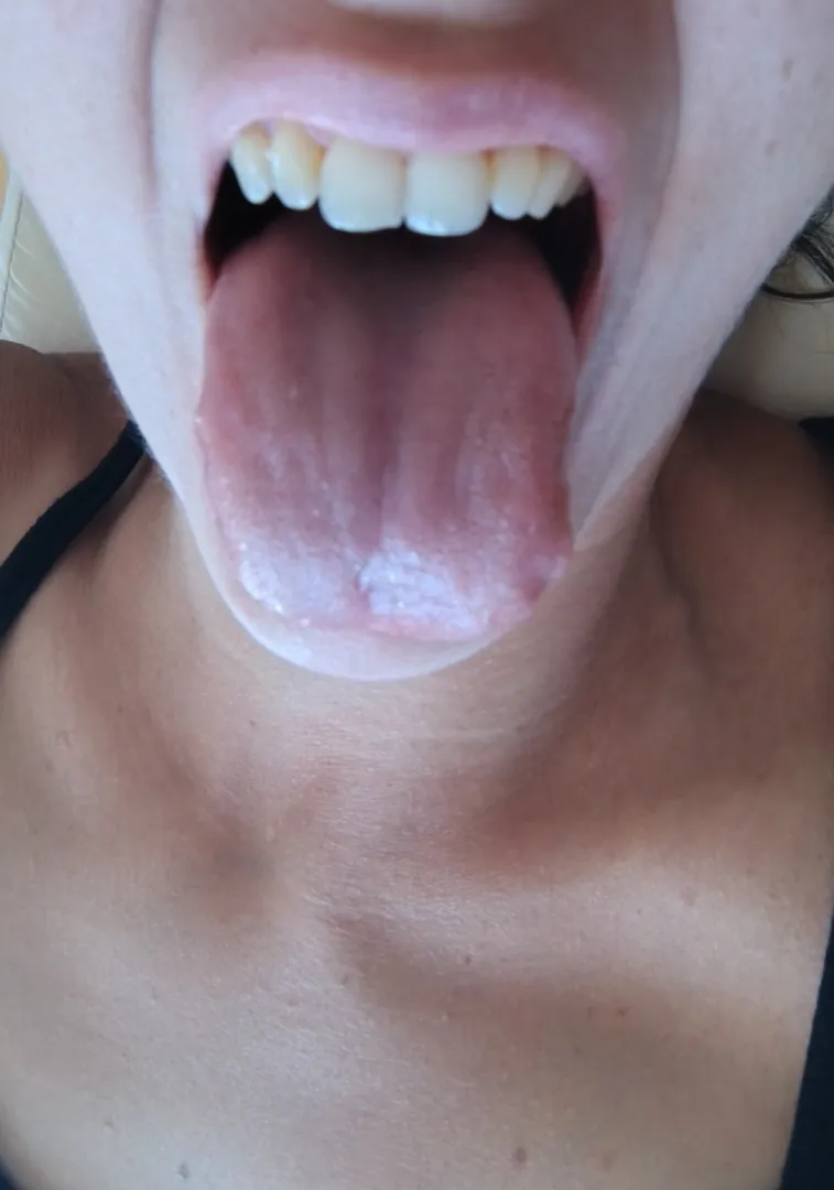 Use my tongue as a ladder {f} posted by belleblackqueen