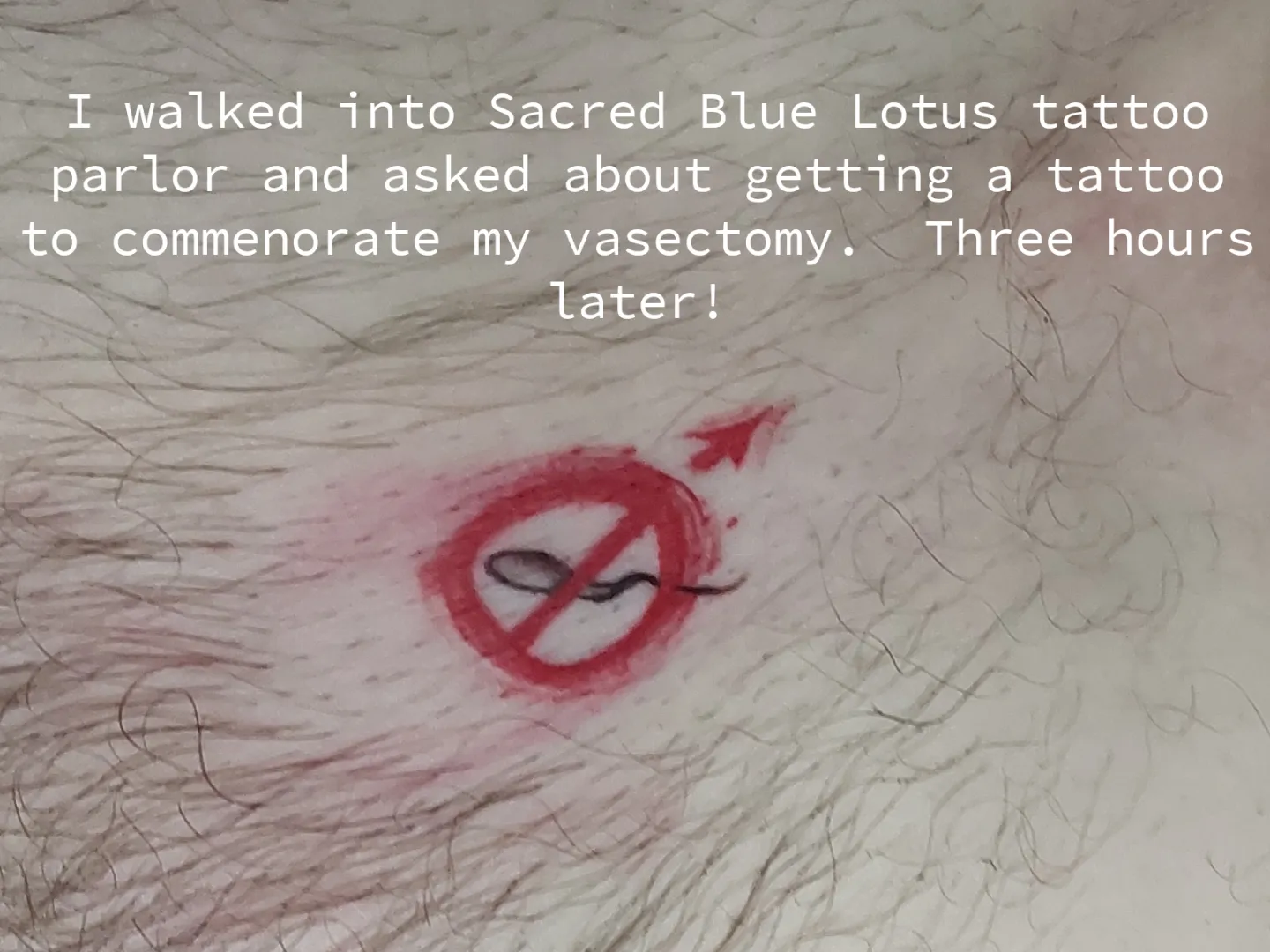 vasectomy tattoo posted by LaMarr-H