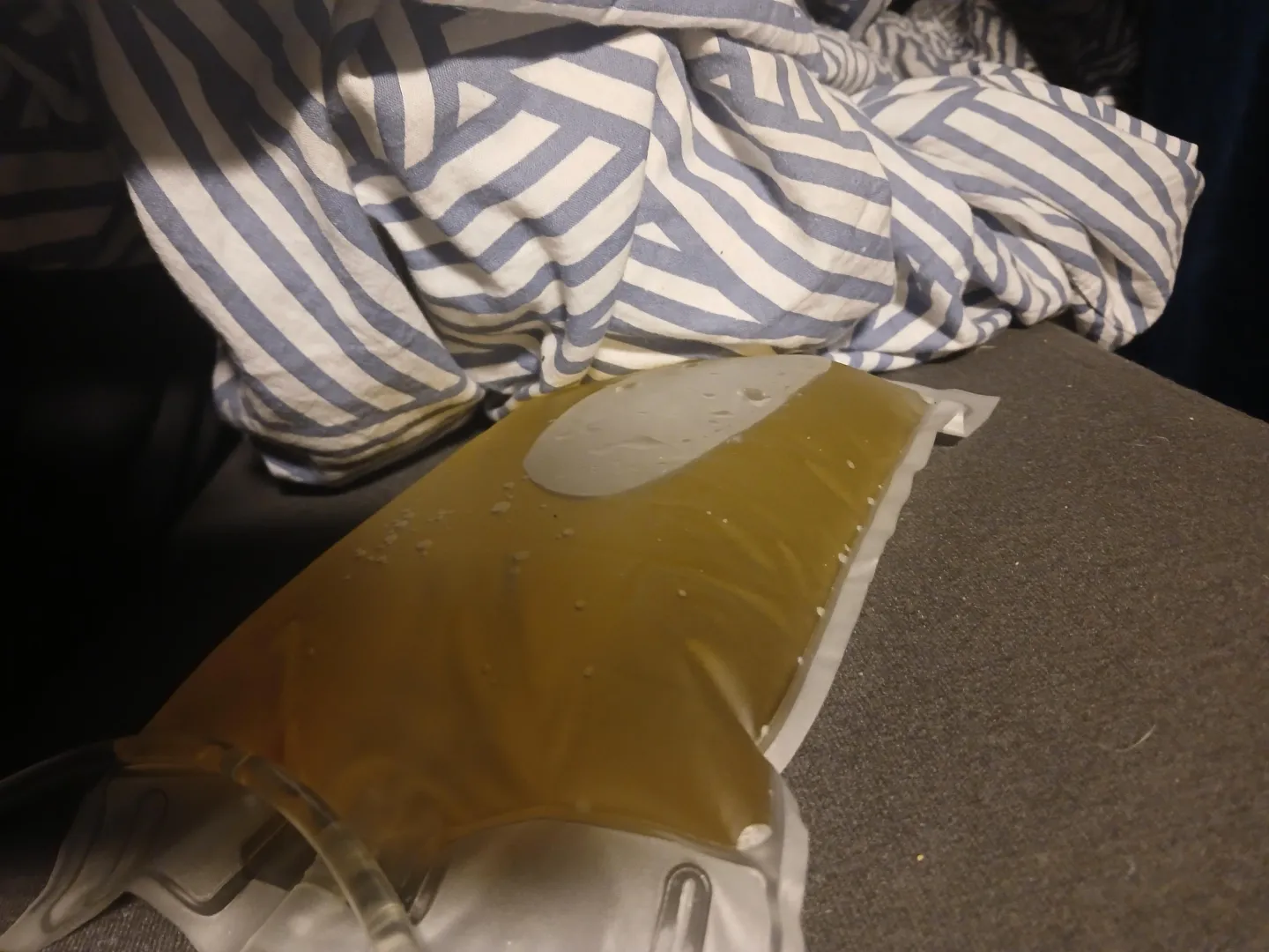 Waking again up to a nice bag full of pee ... posted by baak20001