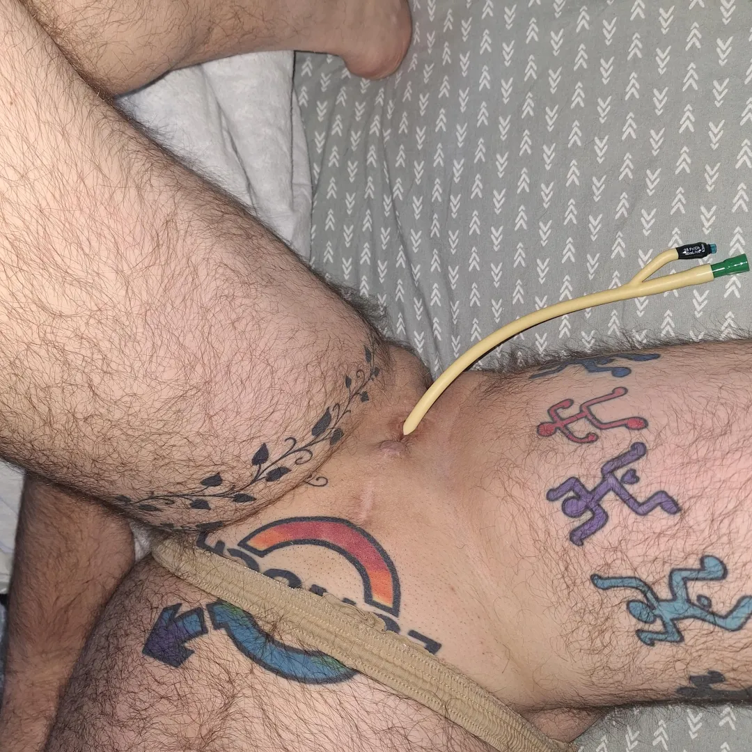 Waking up with a 28 fr catheter posted by split6