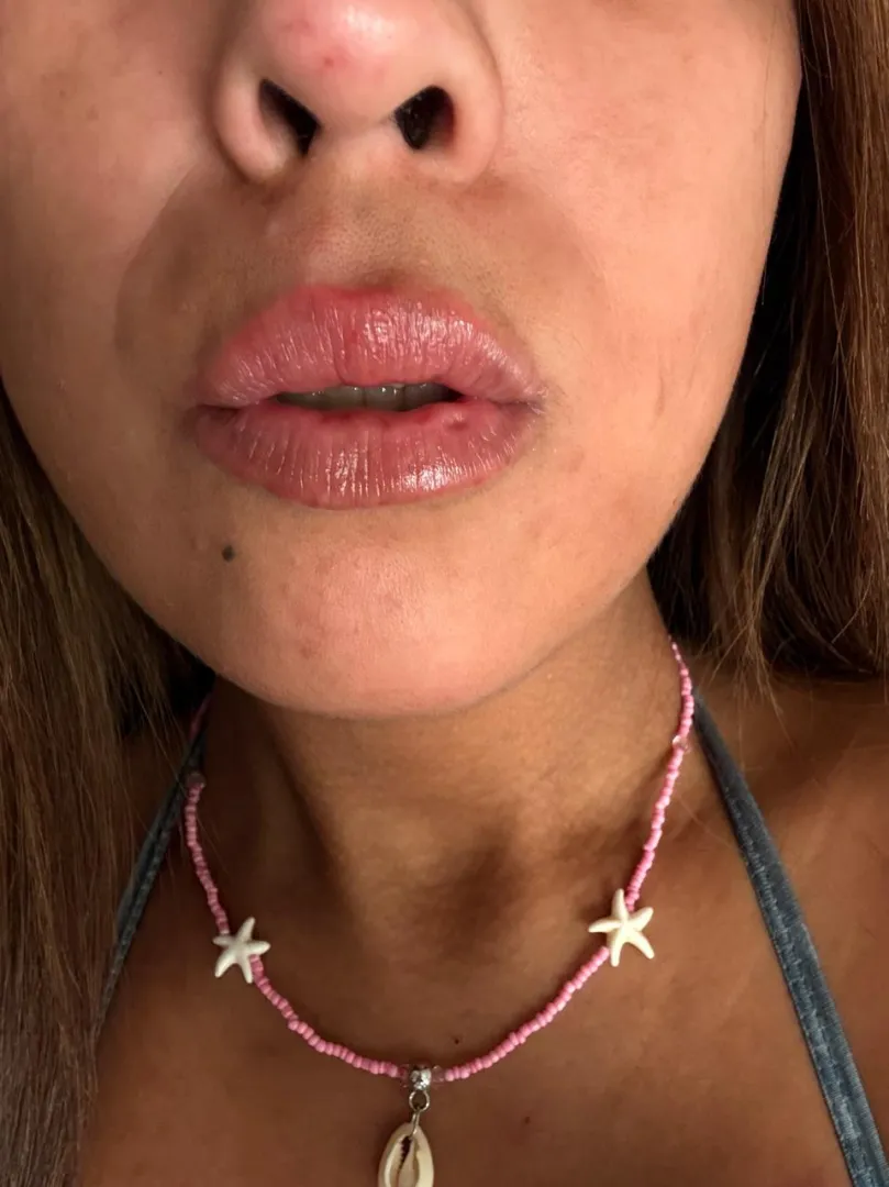 wanna a kiss?? posted by Future-Pain-763