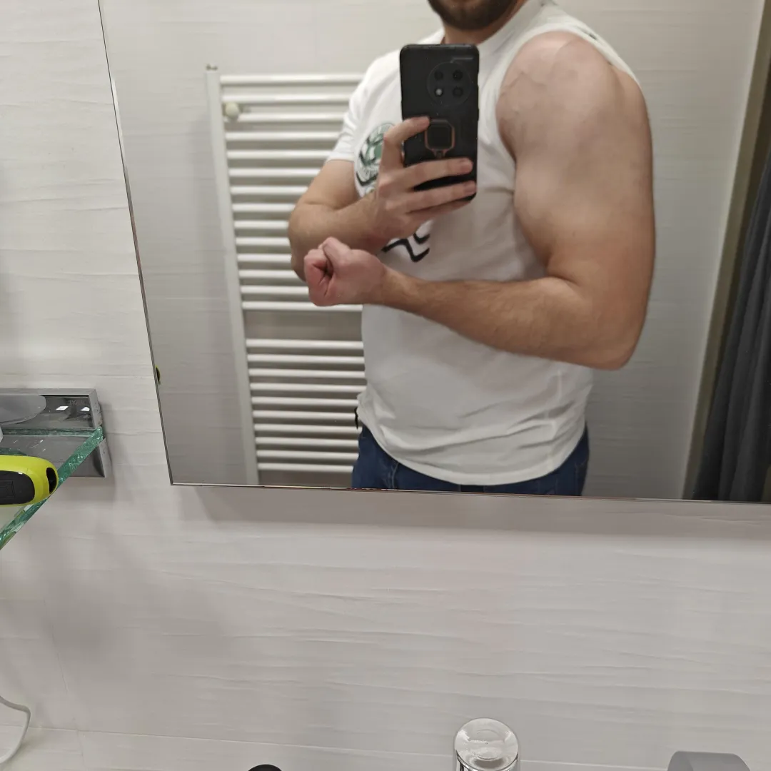 Want to feel them? posted by Automatic-Bluejay518