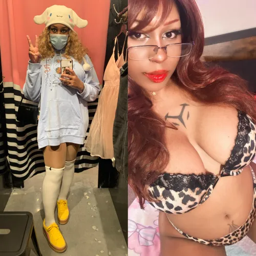 Went from a looser to a hottie thanks to my surgeon!  by venuslyxx