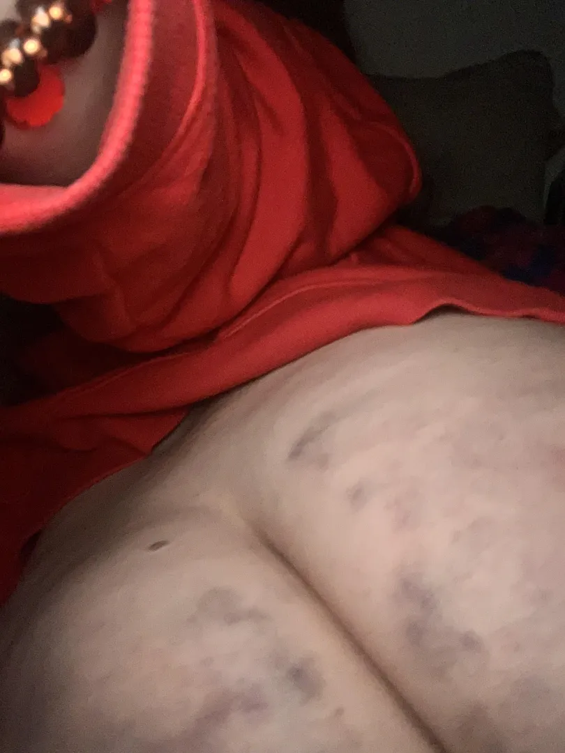 What happens when you lie posted by halebopsalot