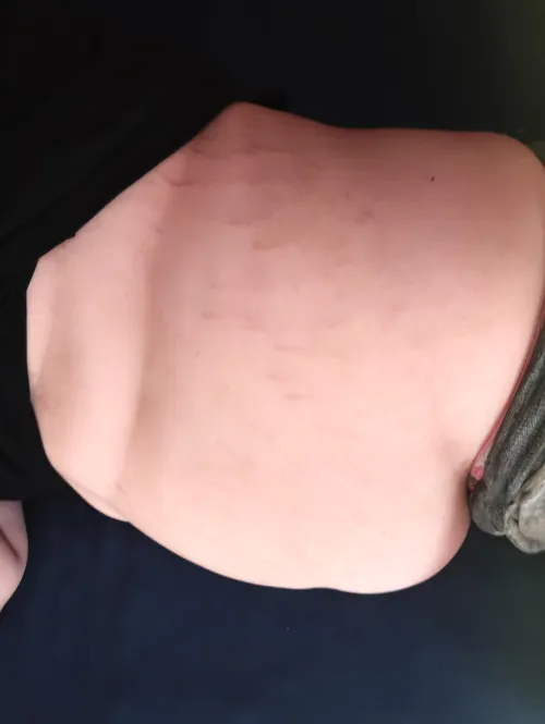 what shape fo you think my belly will become? by Zestyclose-Pass-9141