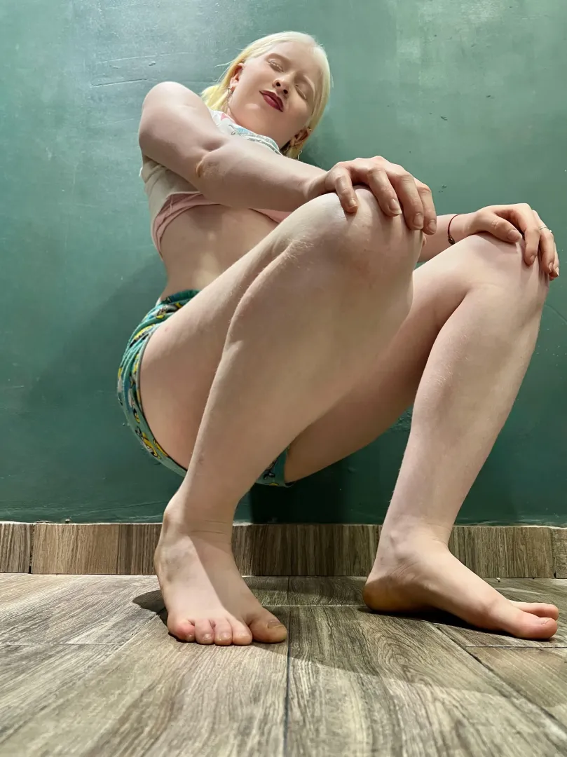 What would you rate my albino legs posted by WickedMistressx
