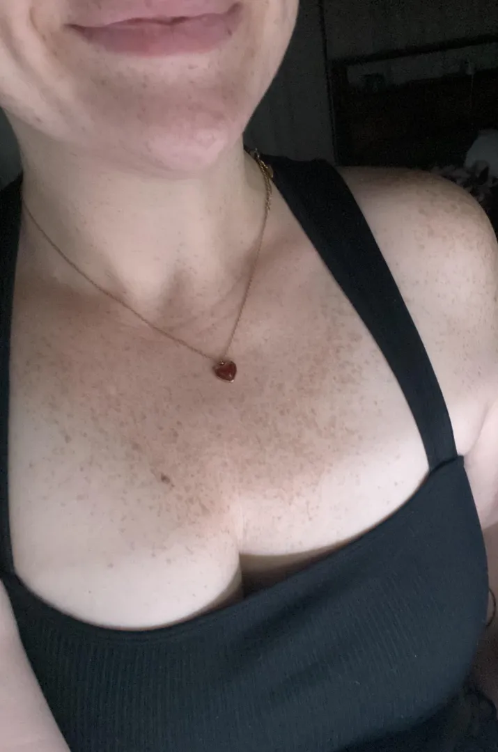 Which freckle is your favorite? posted by marroonedAstronaut3