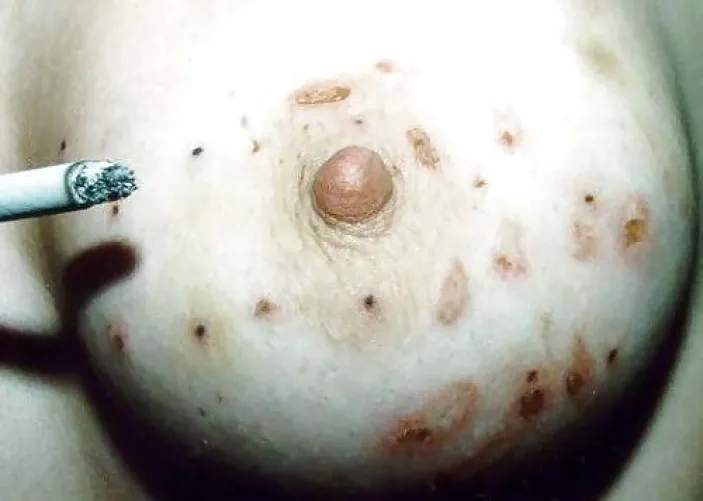 Who needs an ashtray when you have pair of tits by s1ckLy-sadist