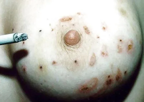 Who needs an ashtray when you have pair of tits posted by s1ckLy-sadist