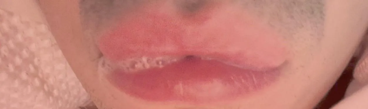 Who needs sucking today then. Message me and we can arrange something. 29 M Oldham posted by Lost_Barracuda_4861