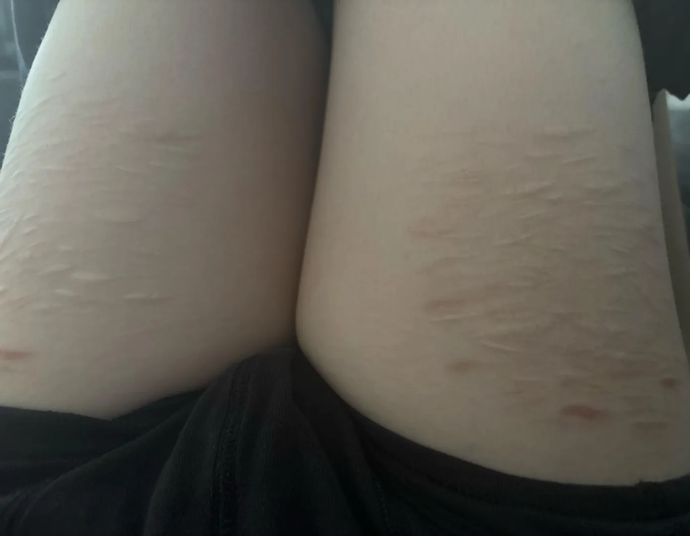 who wants a thigh job :3 posted by Soft_Guarantee_420