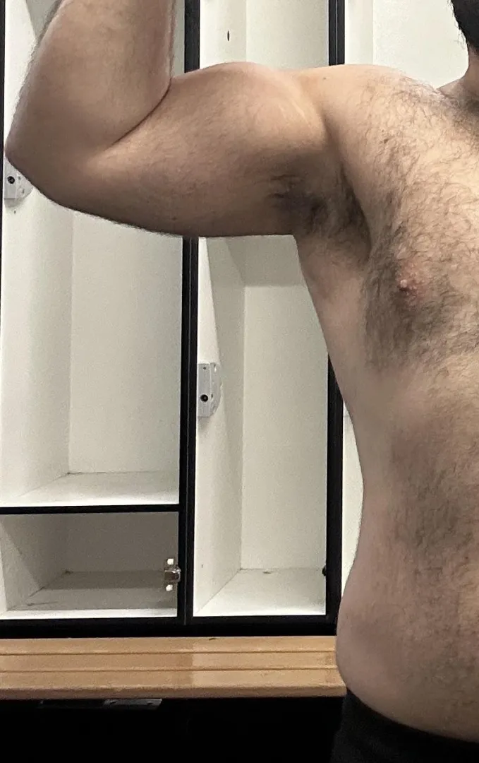 Who wants these in their face? posted by ShortKing8700