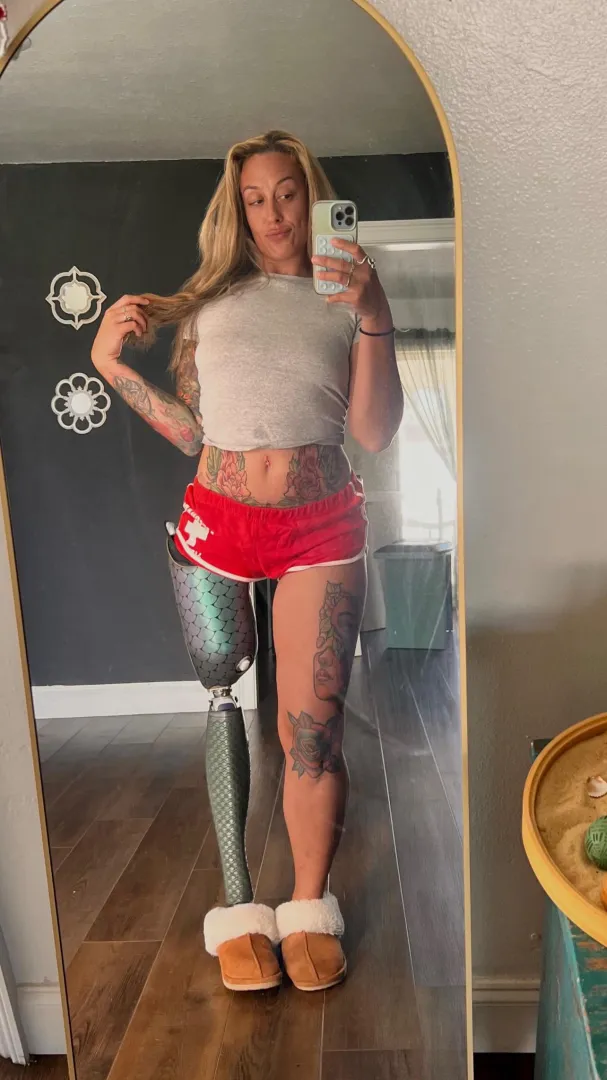 Who wants to lotion my stump? posted by Accomplished-Comb111