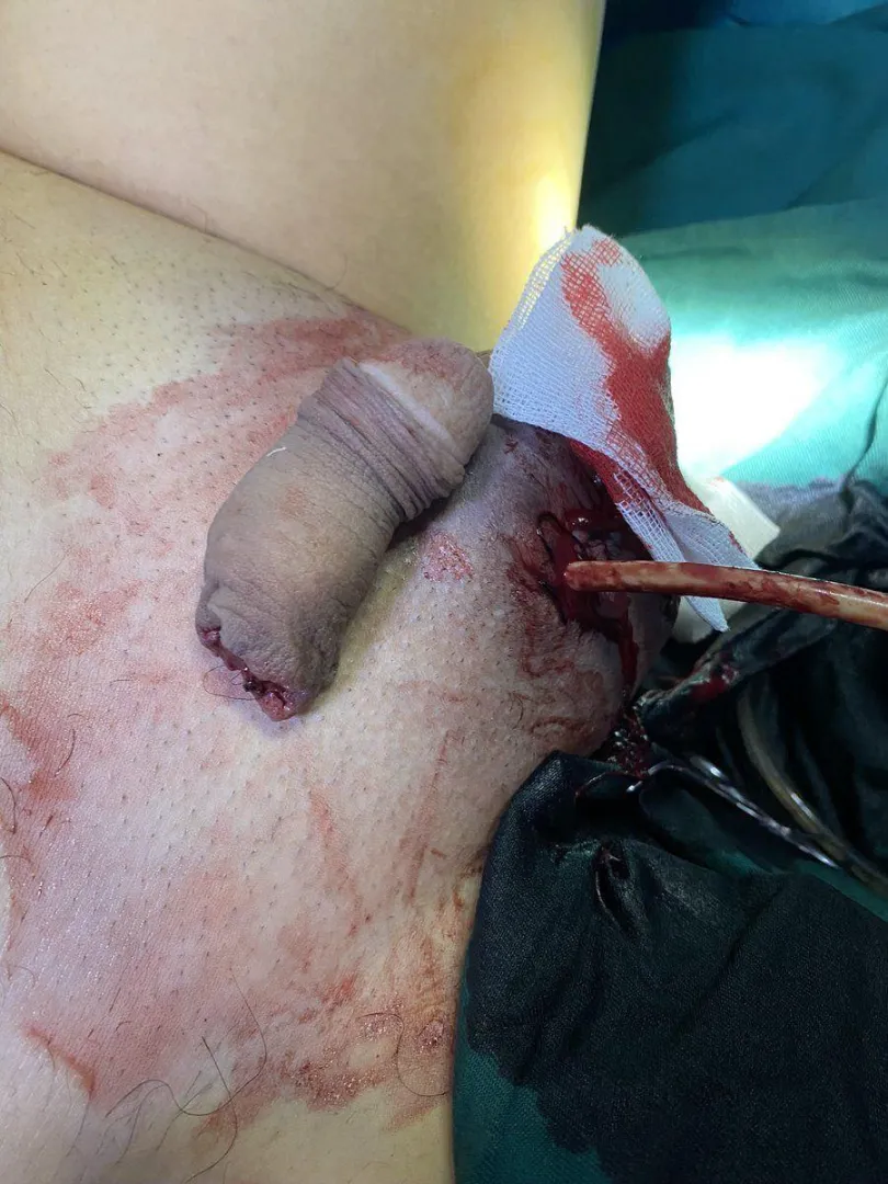 who watching posted by Artistic_One_3689