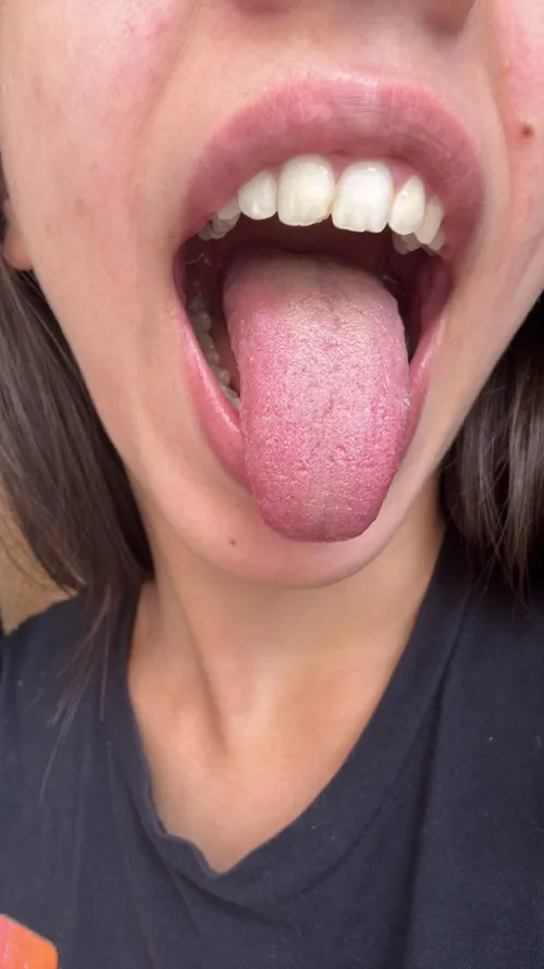 Wide open and ready for you by LiaTouches