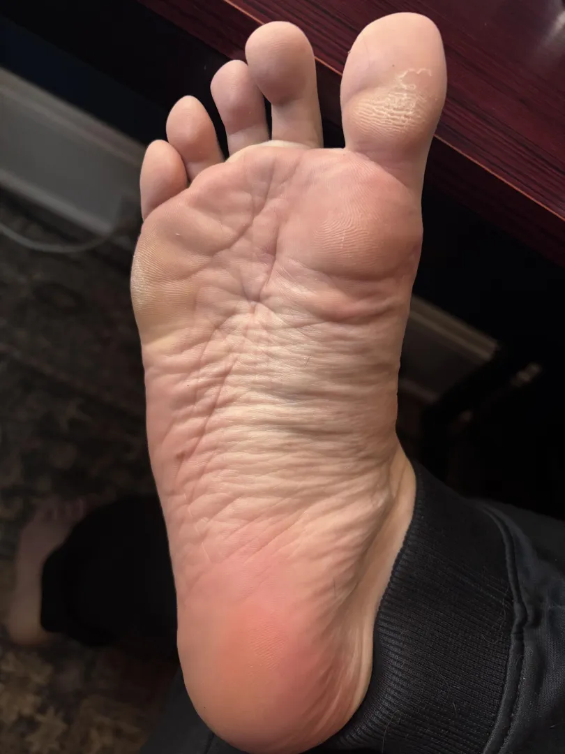 Winter’s been tough on these posted by AssignmentNew8756