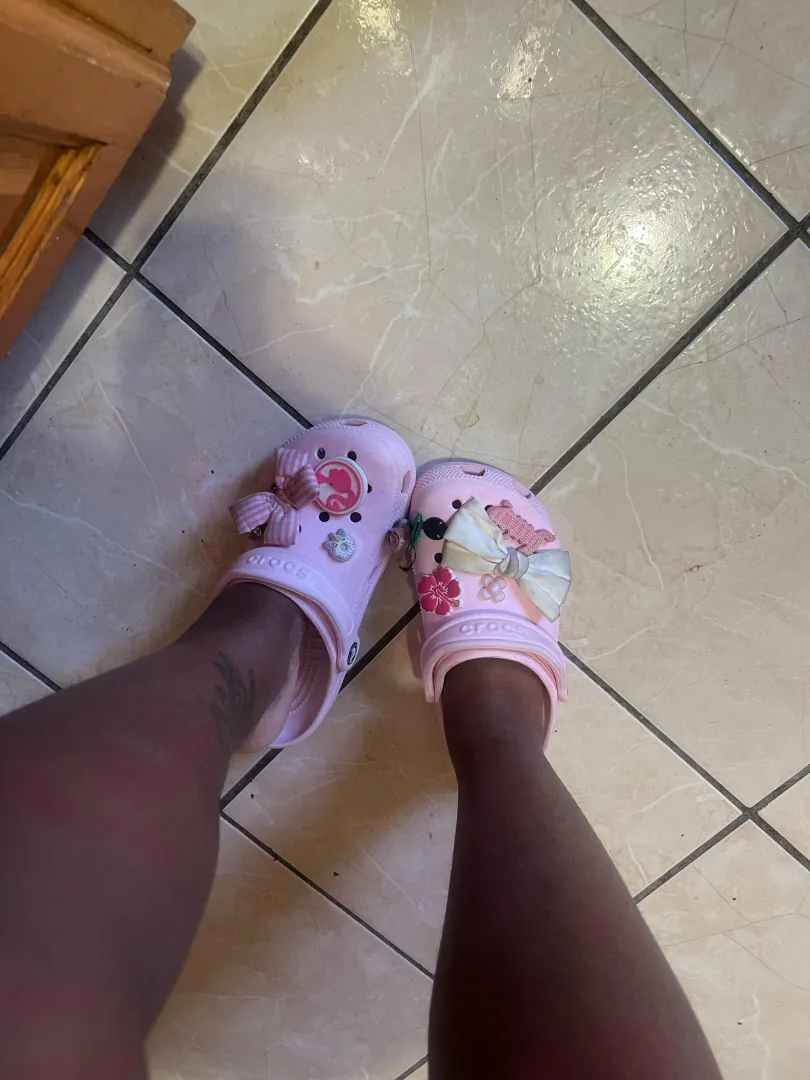 Woke up with swollen ankles  posted by Additional-Craft-970