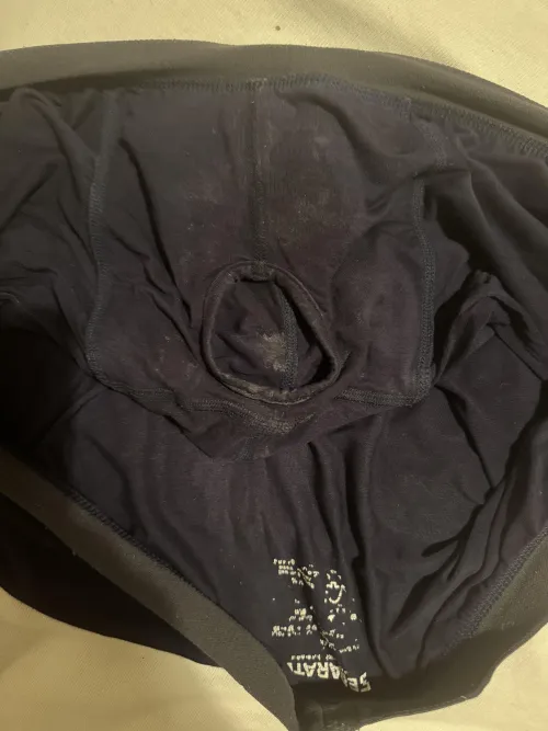 Wore it for 4 days now by Dizzy-Fan1069