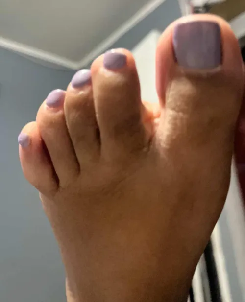 You find yourself with these toes THIS close to you. What do you do by arboldebolas