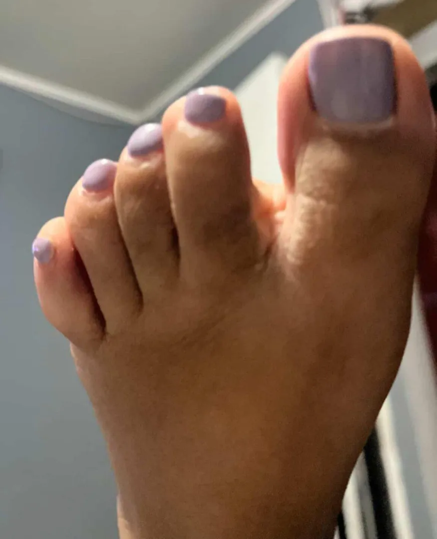 You find yourself with these toes THIS close to you. What do you do posted by arboldebolas
