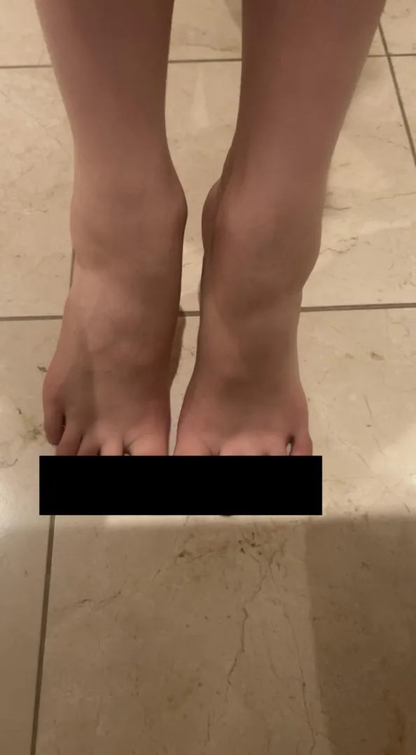 You just want to see what color my toenails are right ?  posted by dark-mist00