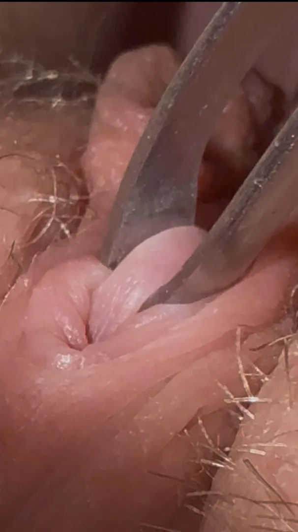 Yumwhat else should I do to it posted by Miserable_Arm4994