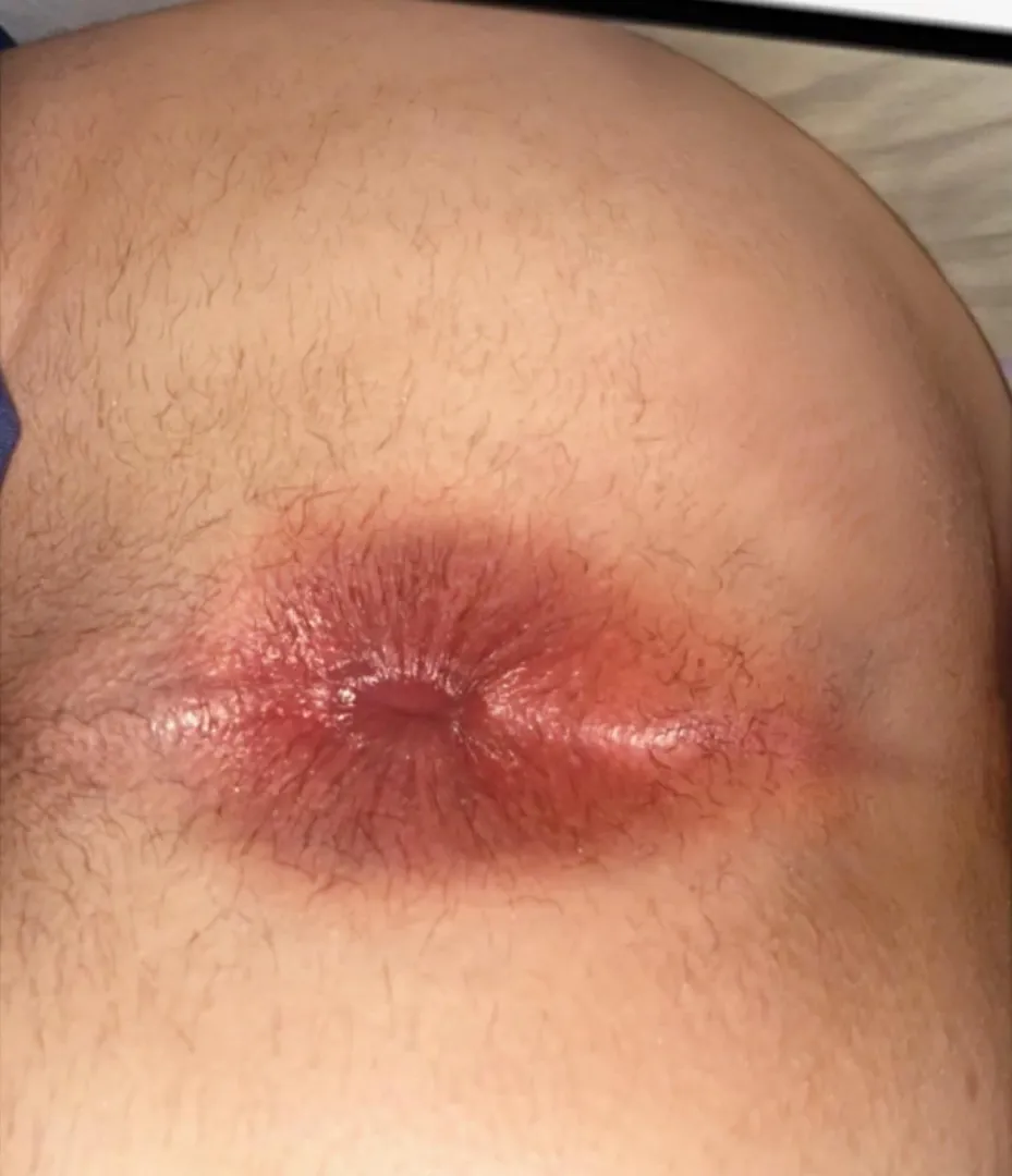 مولعة ضيق posted by EnvironmentalFun6305