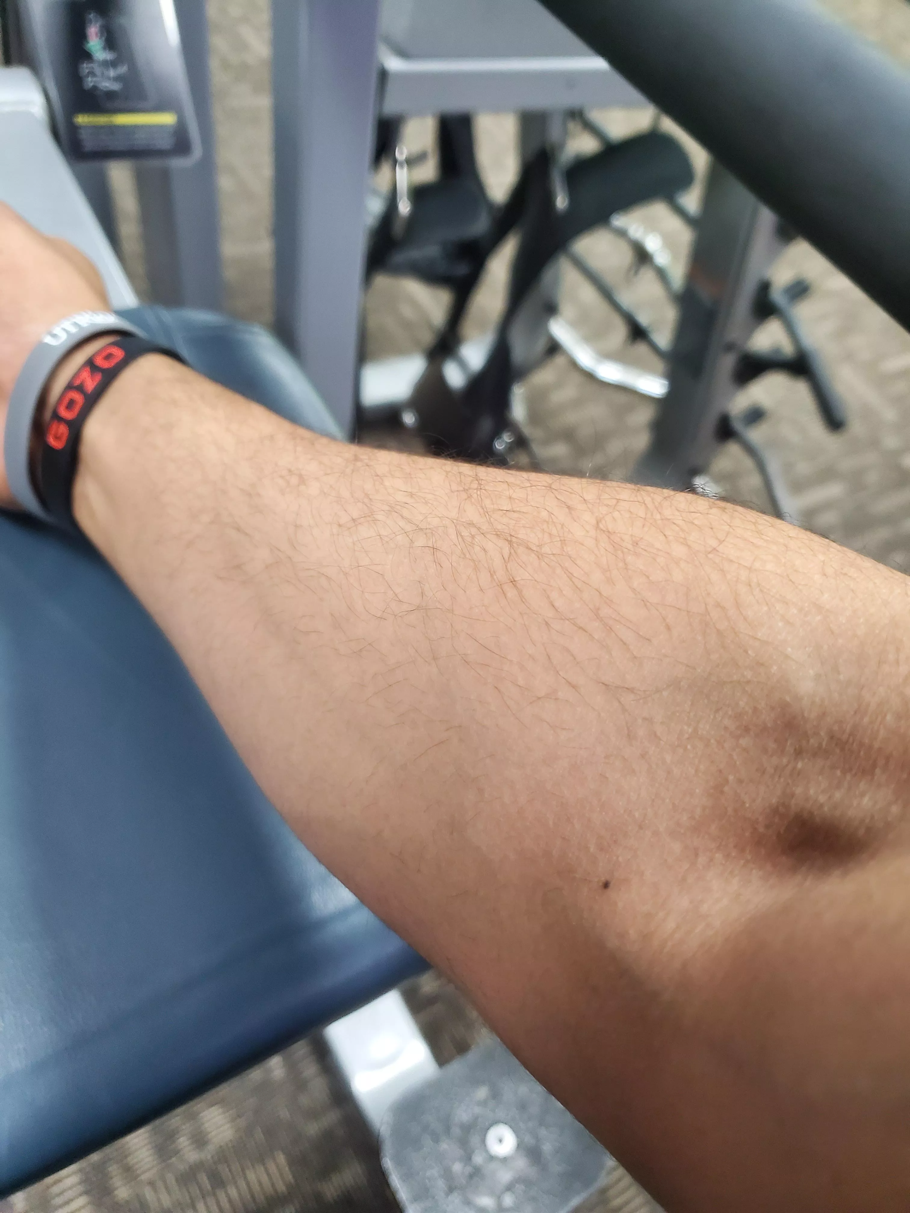 ✌💉 posted by rodiabolkonsky