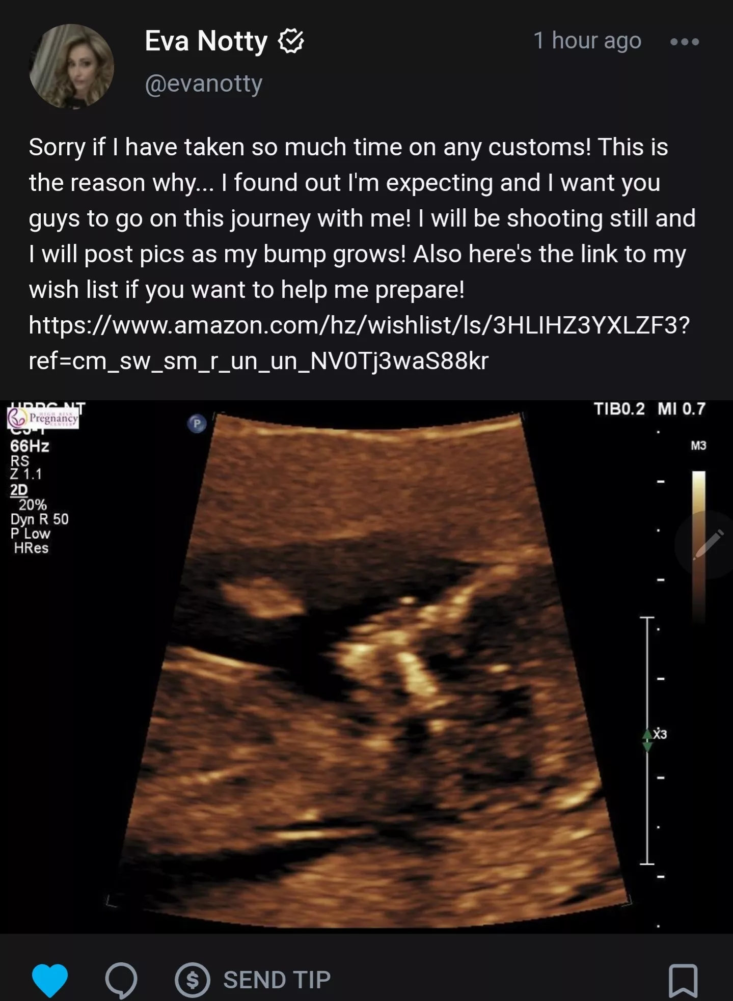 🔥 posted by xHuEx