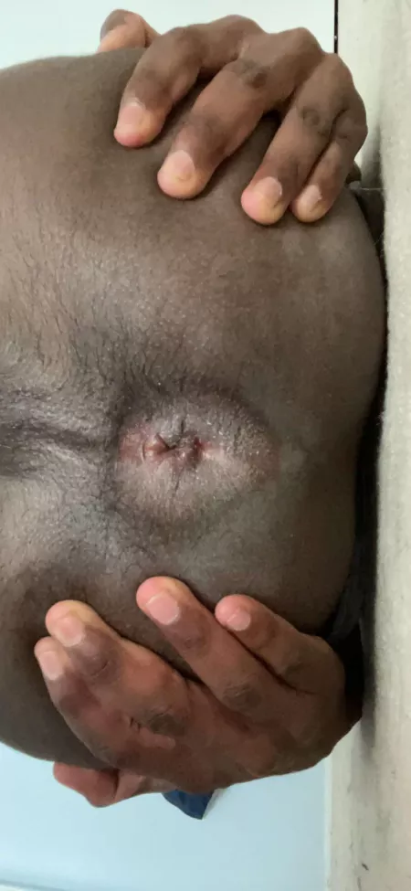 18 gay. I need to be stretched by bi-boy37