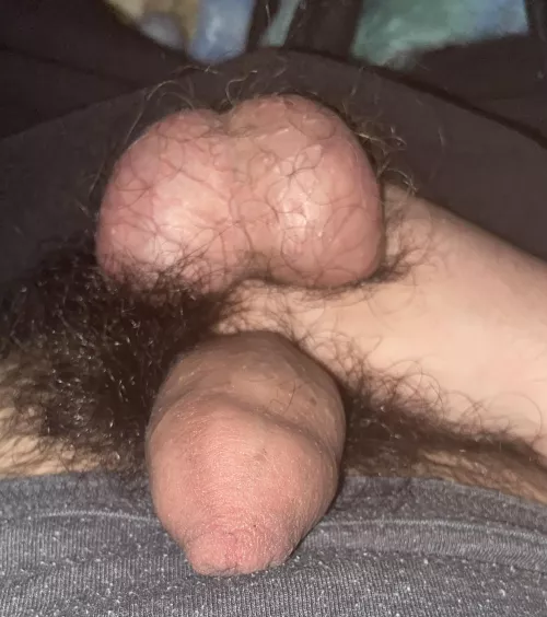 18M hairy balls by Hour_Ad_1150