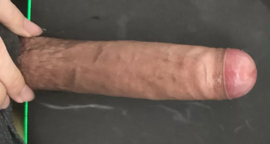 18M, will phimosis scare girls away? by Pronestorm