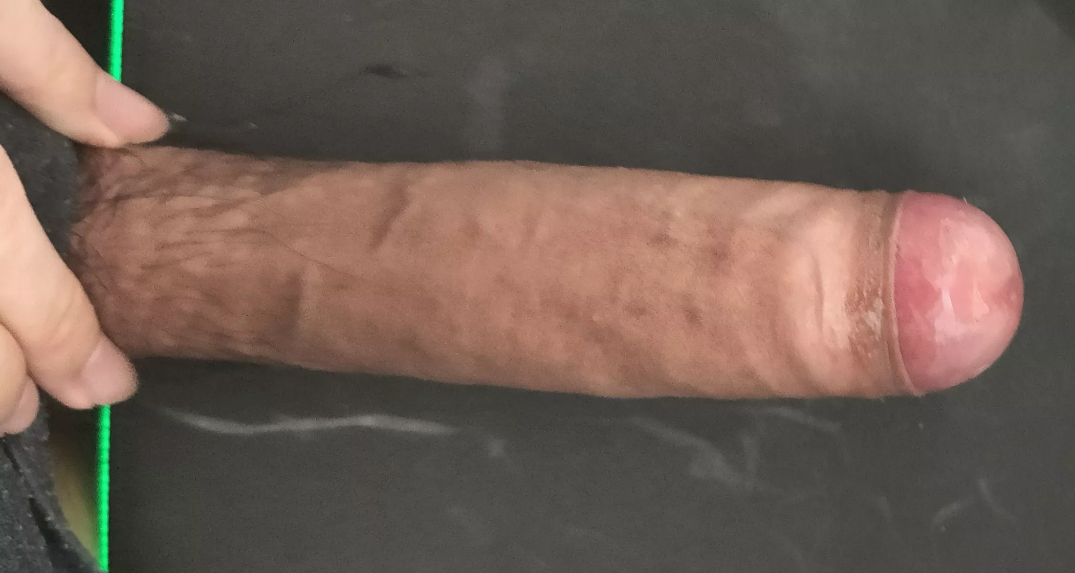 18M, will phimosis scare girls away? posted by Pronestorm