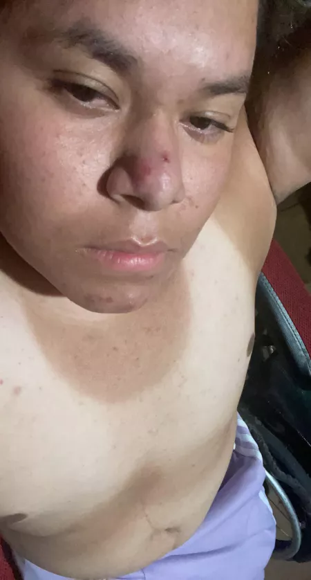 19 anybody wanna play Mario kart, ignore my horrible tan 😭 by Bottom2020disabled