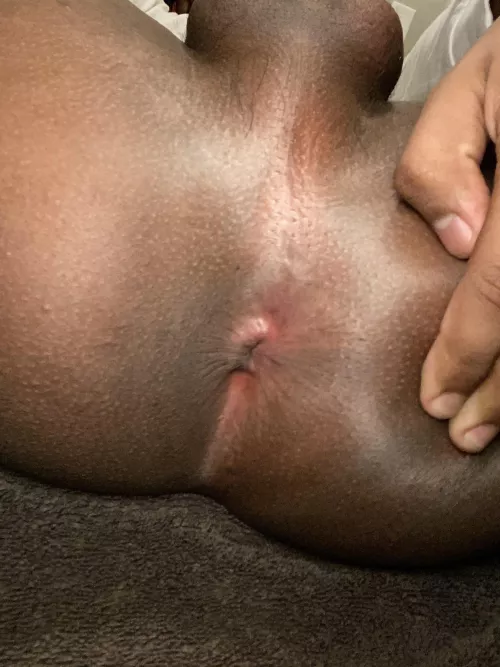 [19] gape my hole by Melanyy231