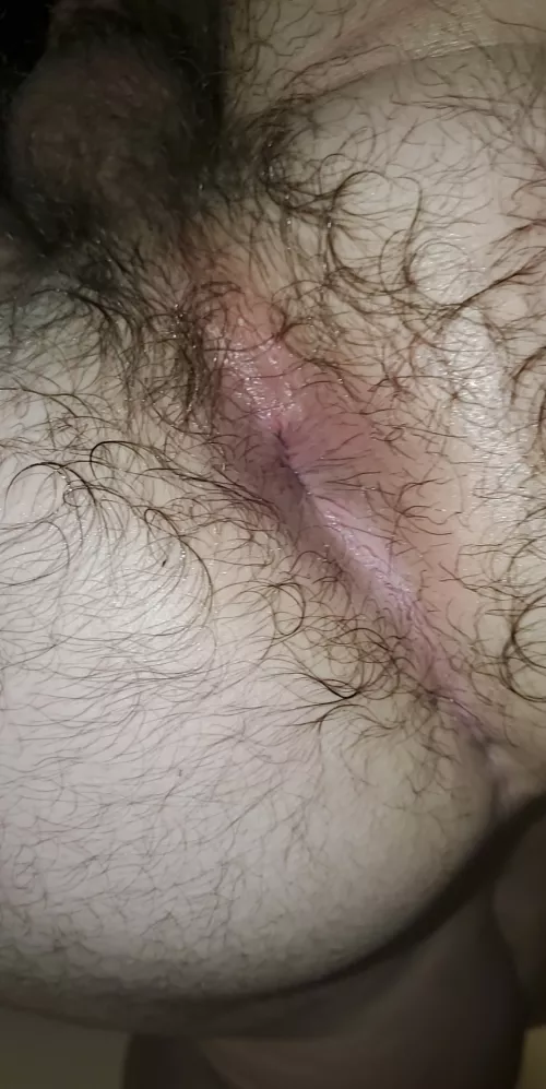 (19) my hole after stretching practice😝 OF below if you wanna see the process + much more;) by Hairyboi18