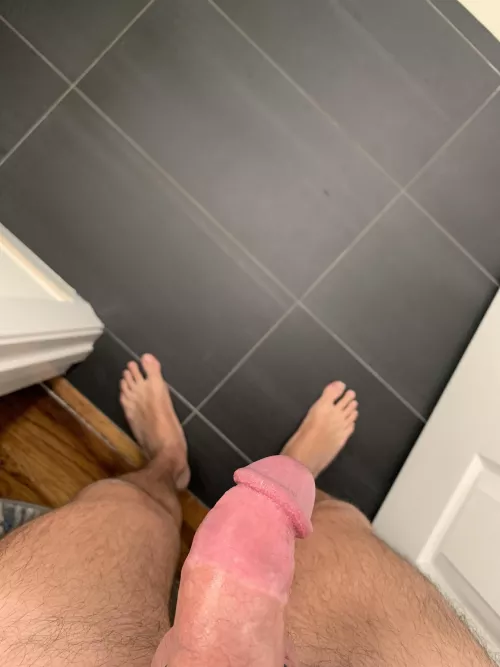 2 years circumcised and proud to be cut by anteaterMD