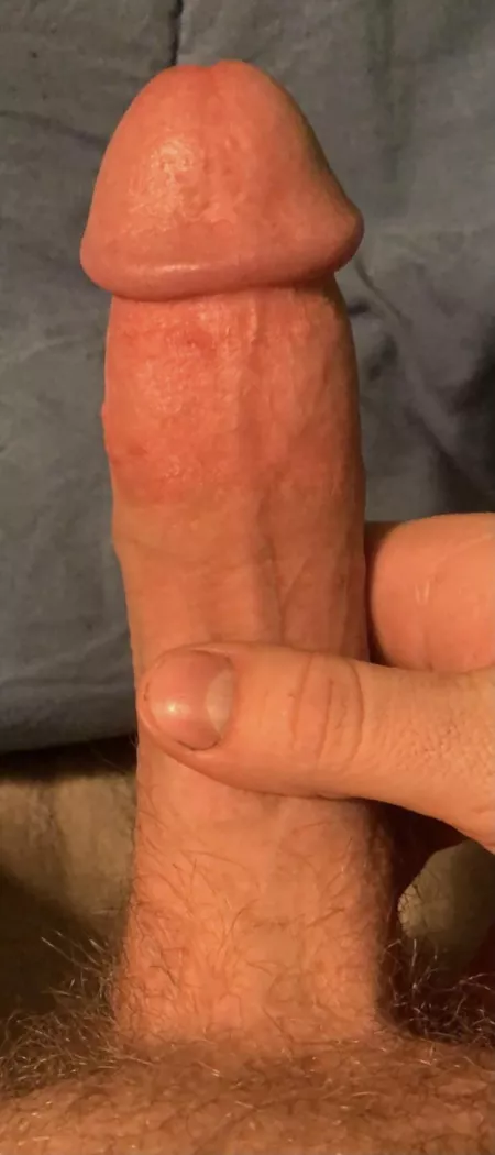 20y/o cock cut at birth by TJC_732