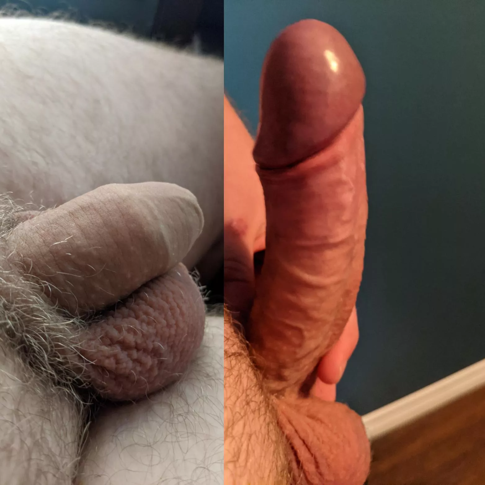 22 Canadian guy here. He's hard for the pic but I'd rather be hard for you 😜 (Kik: DanBaked) posted by YesImFappingRightNow