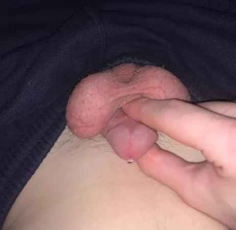 3 lil balls by Significant-Guest552