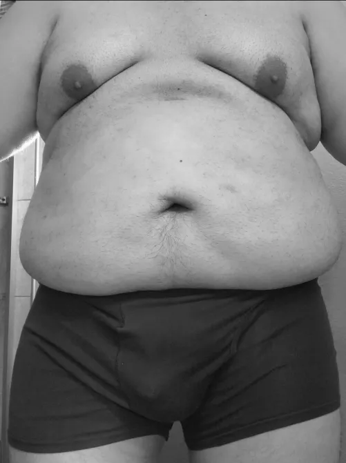 [41]M Bi chubby guy looking for some attention. Hope you like by BigSackSmallCack
