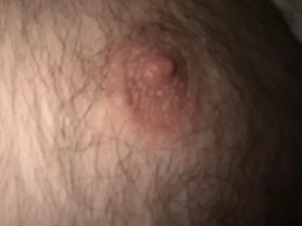 43(m) any ladies care to torture me by biting and sucking my nipples? by abar77_79