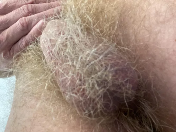 A jungle down there by ectoscruff