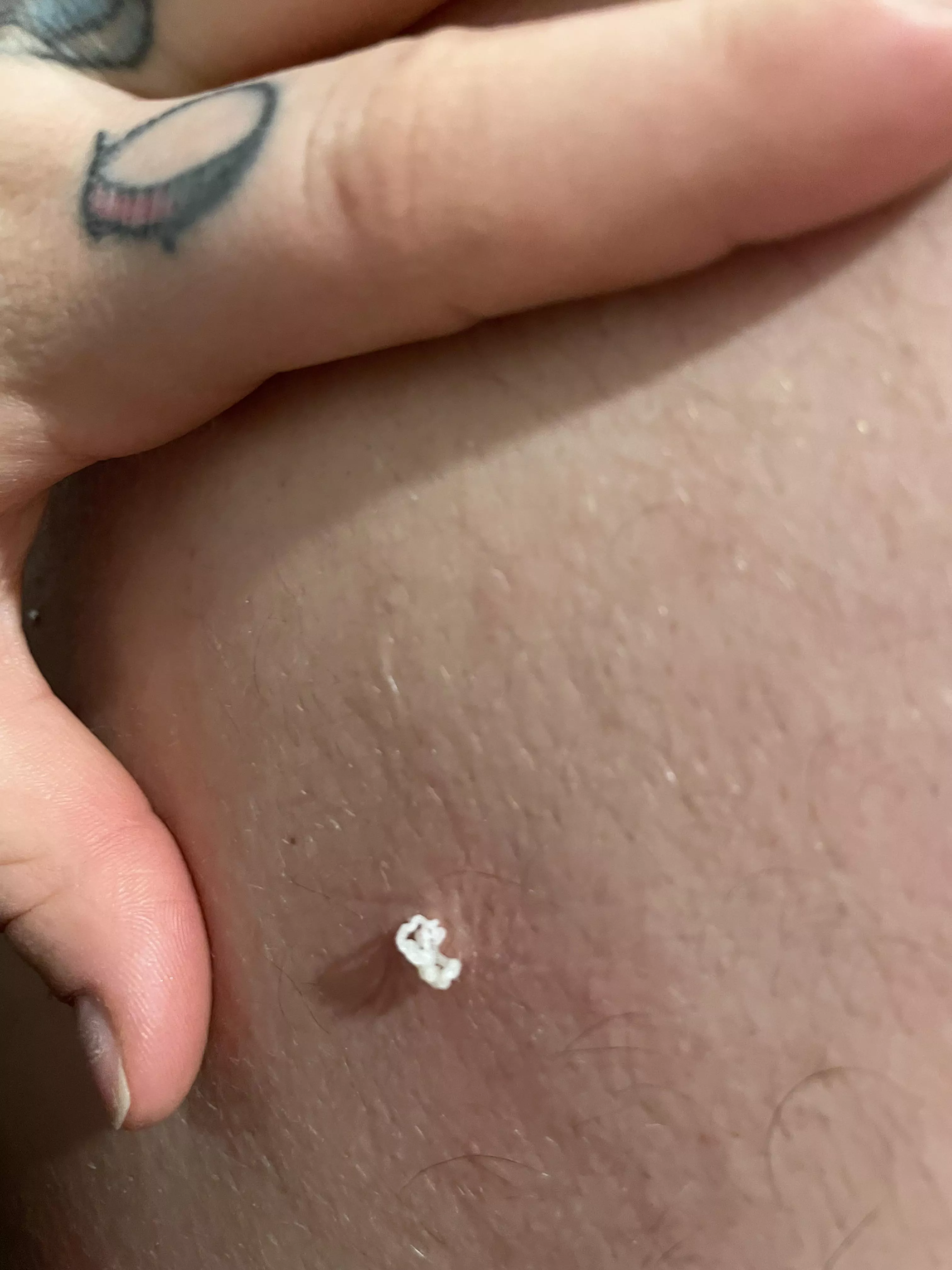 A lil cyst I found on my bfs back posted by _alixx_